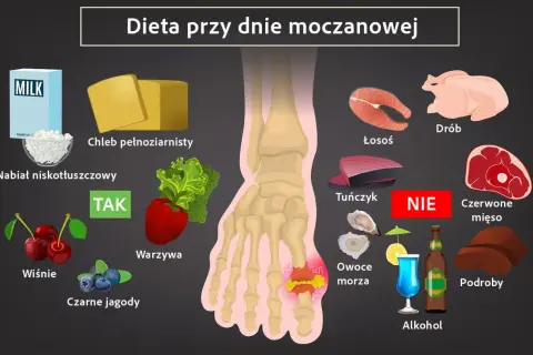 Dieta przy dnie moczanowej: jedz nabiał, chleb pełnoziarnisty, warzywa, wiśnie, czarne jagody. Unikaj czerwonego mięsa, podrobów, owoców morza, alkoholu. Jak obniżyć kwas moczowy? Zmień dietę!