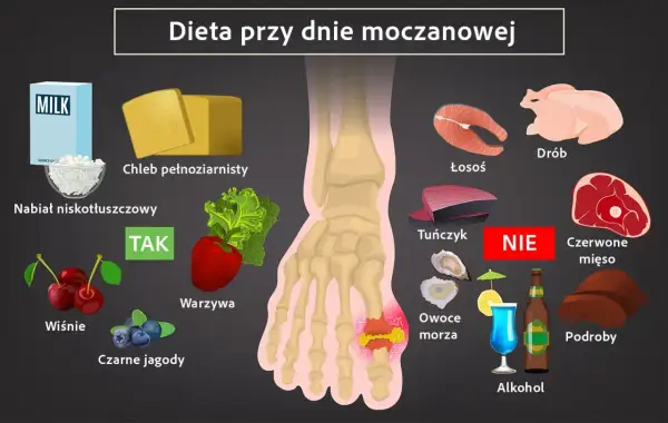 Dieta przy dnie moczanowej: jedz nabiał, chleb pełnoziarnisty, warzywa, wiśnie, czarne jagody. Unikaj czerwonego mięsa, podrobów, owoców morza, alkoholu. Jak obniżyć kwas moczowy? Zmień dietę!